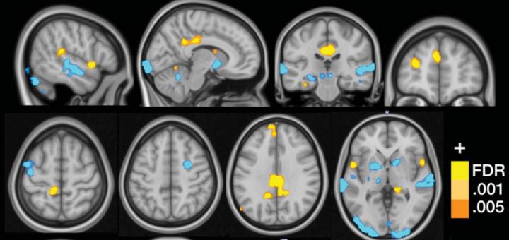 uni-boulder-fibromyalgie